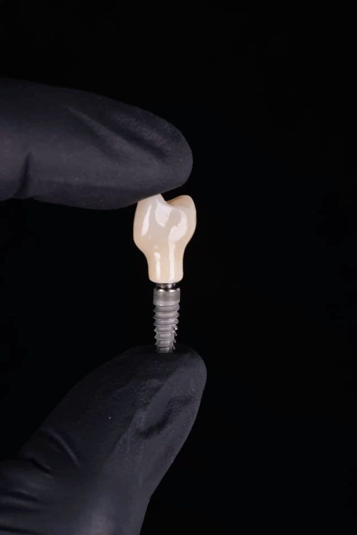 Implant Application