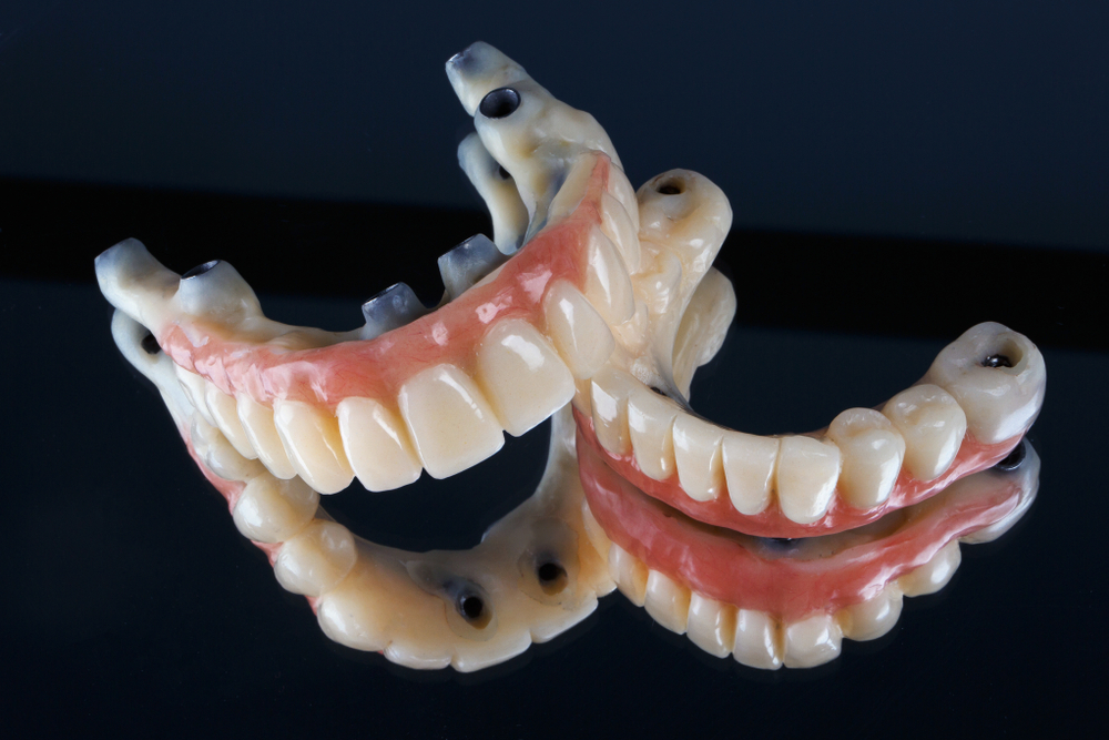 https://ismandental.com/wp-content/uploads/2022/02/Dental-Prostheses-prices.jpg