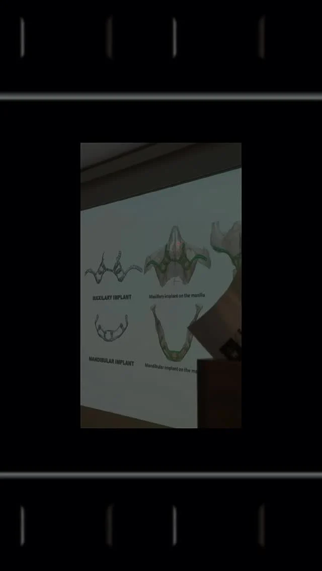 🎥 A glimpse from our remote treatment consultation with our valued patient living in Switzerland 🇨🇭💻

In modern dentistry, one principle stands out:
🦷 Every treatment requires personalized consultation, careful planning, and meticulous execution.

Today, we connected with our patient online and provided a detailed treatment presentation — in their native language, with the help of our interpreter.
Because clear communication is the foundation of successful care. 🌍

⚠️ Dental treatment is not a one-size-fits-all process.
It must be tailored to each individual’s unique needs and oral health.

🙏 We’re grateful to our patient for the trust, and to our dedicated team for their hard work.

📍From Alanya, we continue to bring healthy smiles to patients around the world!

#PersonalizedTreatment #TrustMatters #AlanyaDentalClinic #SwissPatient 🇨🇭 #TreatmentPlanning #ProfessionalCare #RemoteConsultation #NativeLanguageSupport #QualityDentistry #HealthySmile #DentalTourism #IsmanDental